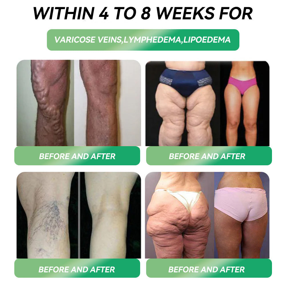 Persistence = Results! Enjoy a limited-time 30% discount on HHVB. Many users choose to purchase 6 boxes at once (42-day supply) to not only solidify results but also enjoy a great value bundle! 👍